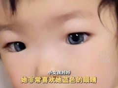 [快讯]8岁女孩患罕见病眼珠变蓝色 蓝瞳宝贝的日常生活记录