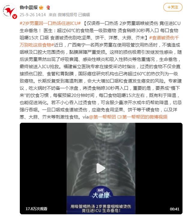 2岁男童因一口热汤住进ICU