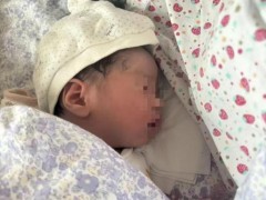 [快讯]27天婴儿治疗黄疸时死亡 监控揭示真相