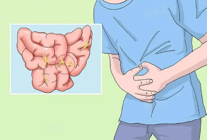 孙子在肚子上蹦了几下 爷爷动脉破裂 