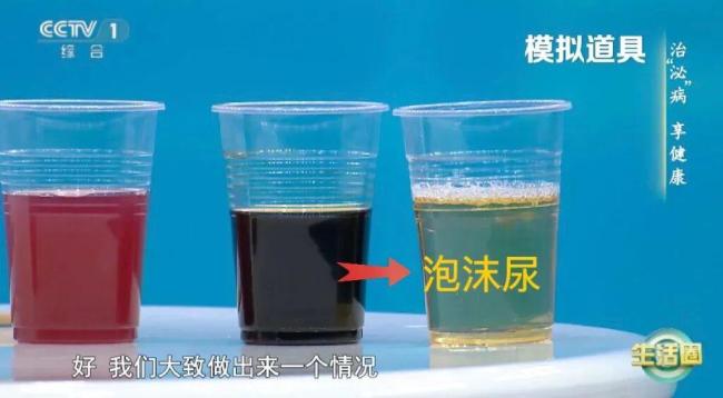 喝水后的5个异常可能是身体求救信号