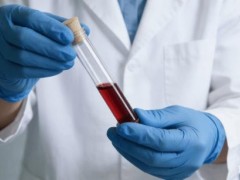 山东发现1例钻石血 比熊猫血更罕见!!