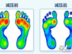 [快讯]33岁“糖友”脚底反复溃烂 足部畸形导致