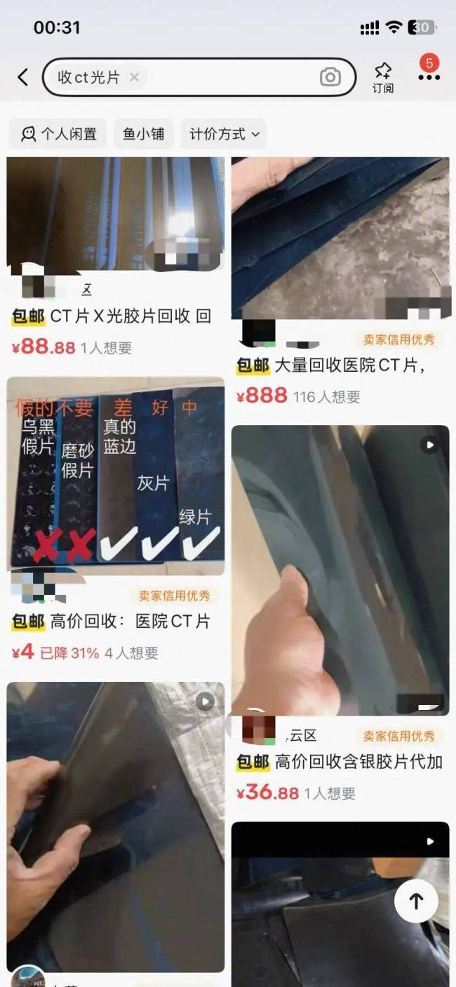 1.5元收一张旧CT片？千万别卖