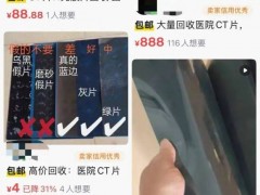 [快讯]1.5元收一张旧CT片？千万别卖 非法提炼污染环境