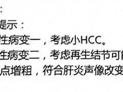 [快讯]男子肝癌诊断存争议卫健委介入 多家医院检查结果不一