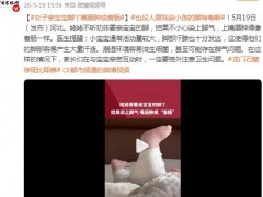 女子亲宝宝脚丫嘴唇肿成香肠 ！！（图）