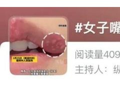 聊聊:30岁女子嘴角长水疱未重视竟脑死亡 警惕疱疹风险